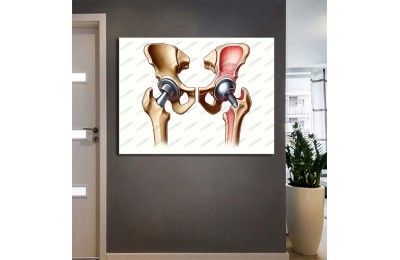 Hastane Tablosu, Hastane Dekorasyonu, Sağlık Tabloları hst195