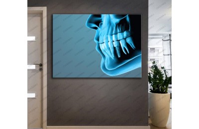 Dişçi Tablosu, Diş Kliniği Tablosu  dsc-28R